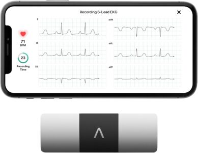 KardiaMobile 6-Lead Personal EKG Monitor Sale